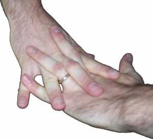 Resultado de imagem para estalar demais as suas mãos