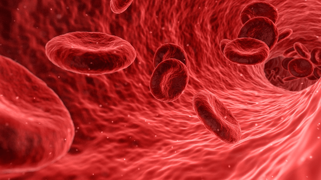 making strides in sickle cell disease research 280427
