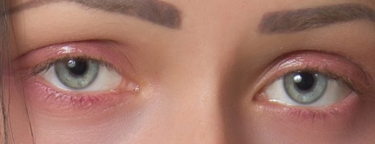 Woman sleepy eyes 770x297 1