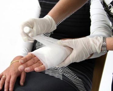 Dressing injured hand medicine health care hospital bandage 370x297 1