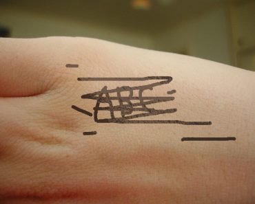 Permanant marker on skin 370x297 1