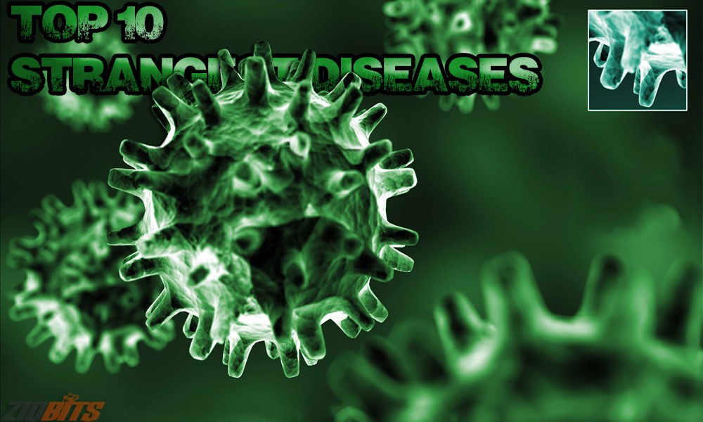most exotic diseases