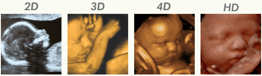 Diferença entre 3D e 4D