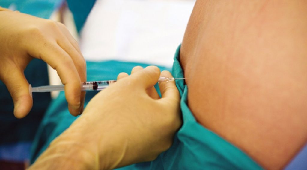 anestesia epidural