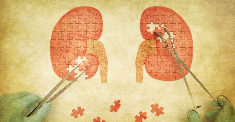 How To Use Apple Cider Vinegar To Treat Kidney Stones 770x402 1