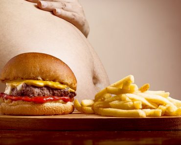 obesity 370x297 1