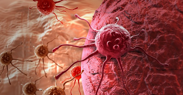 Can Bacterial Infections Lead To Cancer1 770x402 1