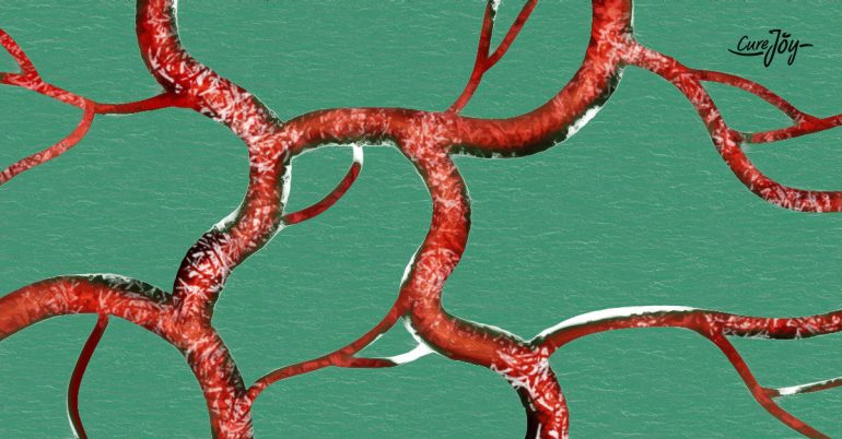 TYPES OF BLOOD INFECTIONS 770x402 1