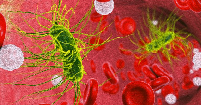 Treatment for bacteria in blood 770x402 1