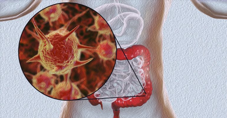 What Are The Root Causes Of Digestive Problems 770x402 1