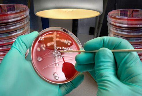 7 Dangerous Diseases Caused By Bacteria