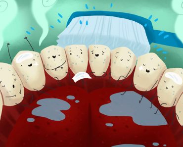 teeth 370x297 1