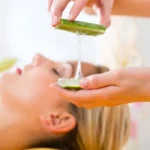Get Rid of Acne by Aloe Vera Gel