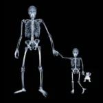 X ray Accidental Scientific Discoveries